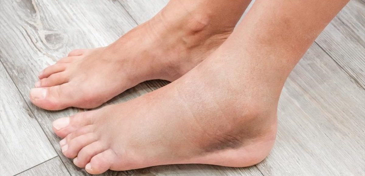 &nbsp;